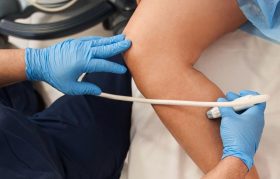 Ecografie Doppler Cluj Ecografie Doppler Cluj