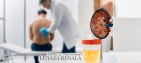 Litiază renală (sau pietre la rinichi) – simptome, diagnostic, tratament Litiază renală (sau pietre la rinichi) – simptome, diagnostic, tratament